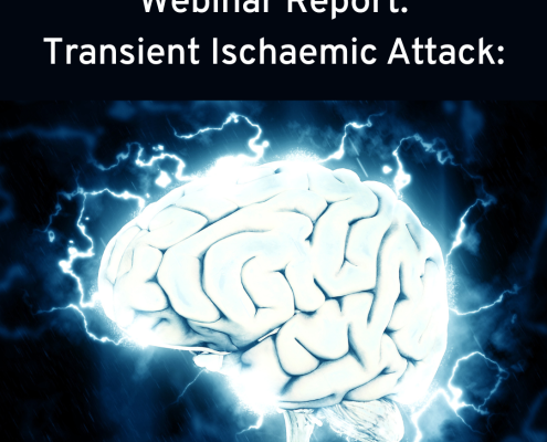 Image of brain and activity on black background