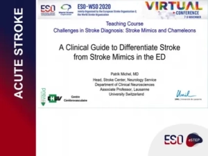 A Clinical Guide to Differentiate Stroke from Mimics in the ED